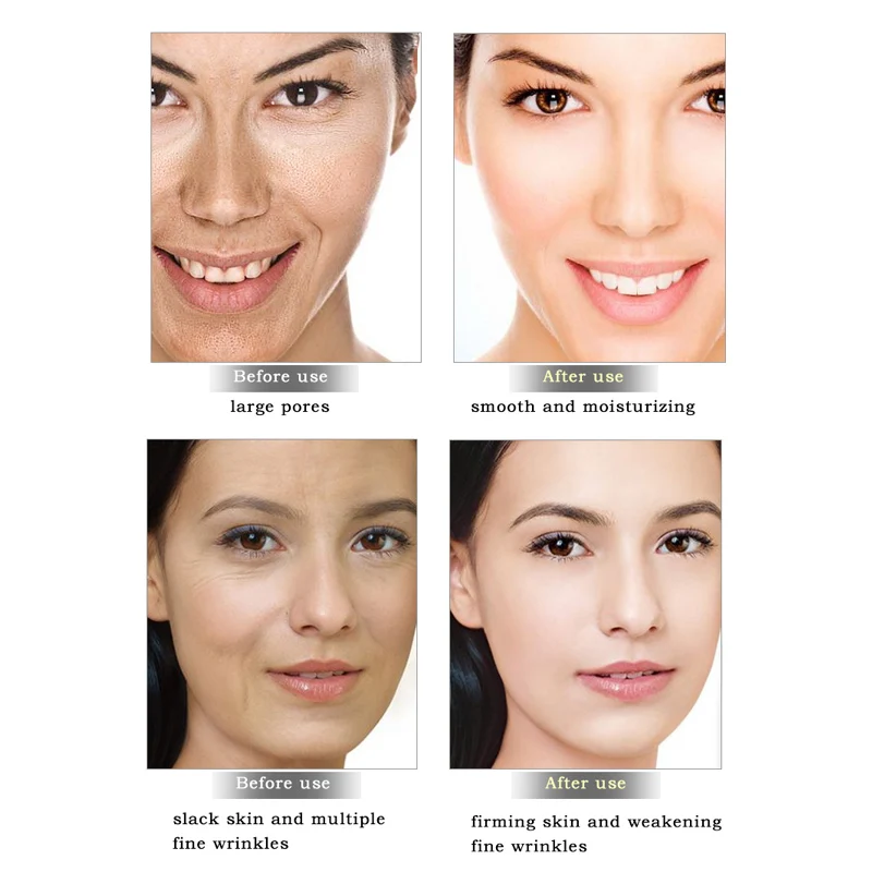 cea mai bună îngrijire a pielii faciale anti-îmbătrânire jintropin anti-imbatranire